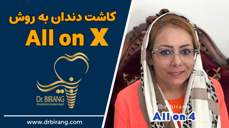 ایمپلنت فوری در یک جلسه بدون درد و خونریزی | دکتر احسان بیرنگ متخصص ایمپلنت دکتر احسان بیرنگ