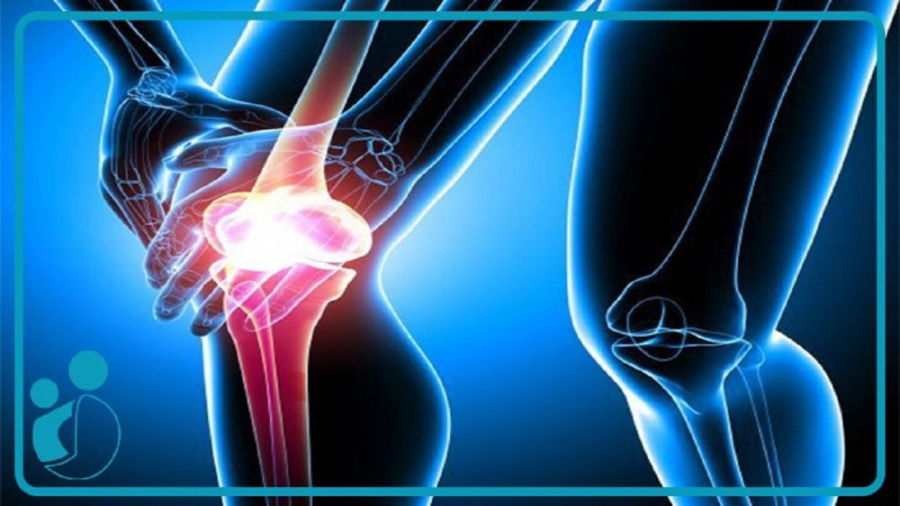 مهمترین عوامل ایجاد کننده آرتروز چیست؟ مهمترین عوامل ایجاد کننده آرتروز چیست؟