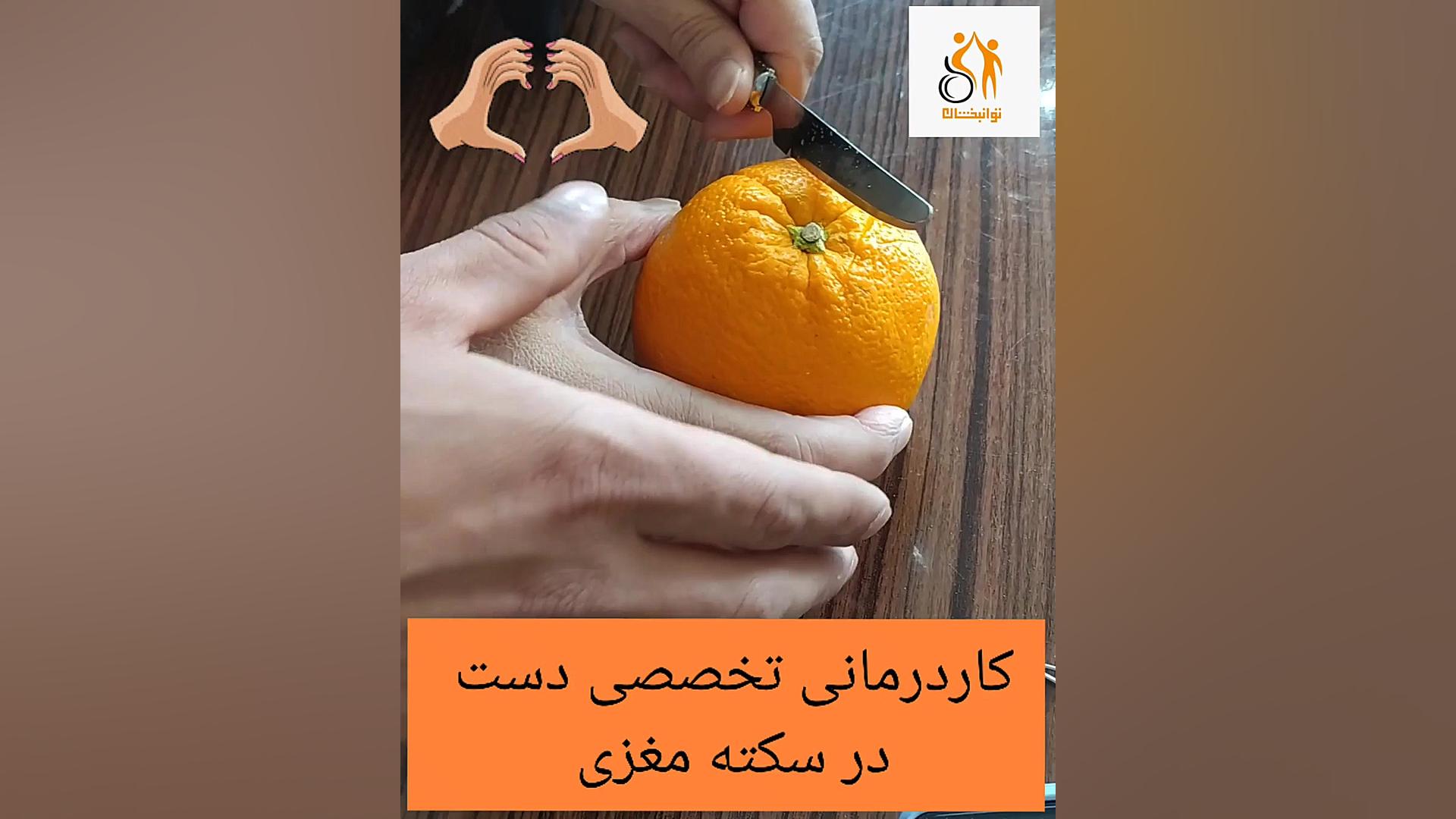 کاردرمانی تخصصی دست سکته مغزی|کاردرمانی مشهد ۰۹۳۳۸۲۵۷۳۱۴ ابرسانی پوست