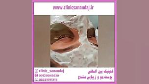 انواع فیشیال پوست تخصصی تزریق بوتاکس