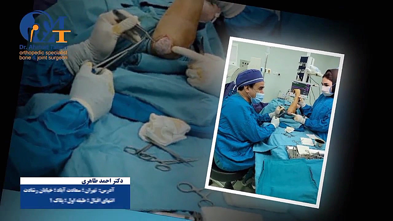 درمان بیماری بورسیت آرنج(بورسیت الکرانون) استوری