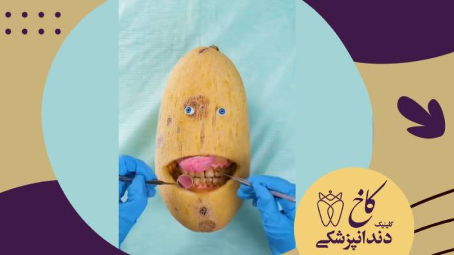 عفونت لثه! کلینیک دندانپزشکی کاخ