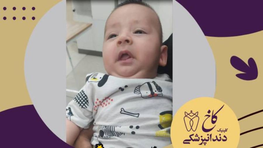 آیا نباید ایشون رو یک لقمه چپ کنیم؟ کلینیک دندانپزشکی کاخ