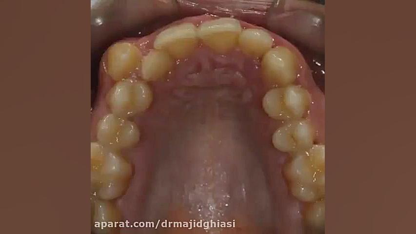 ارتودنسی دندان دکترمجیدقیاسی