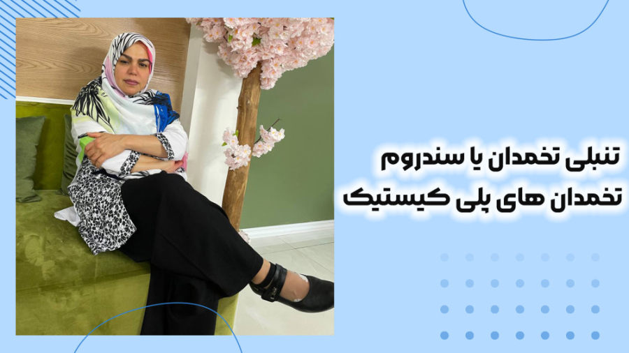 تنبلی تخمدان یا سندروم تخمدان های پلی کیستیک لیزر صورت