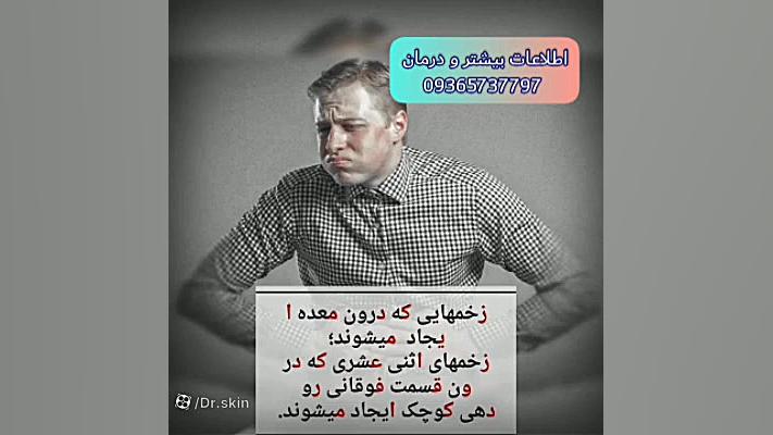 علائم دل درد و رفلاکس معده چیه؟؟ زیبایی پوست