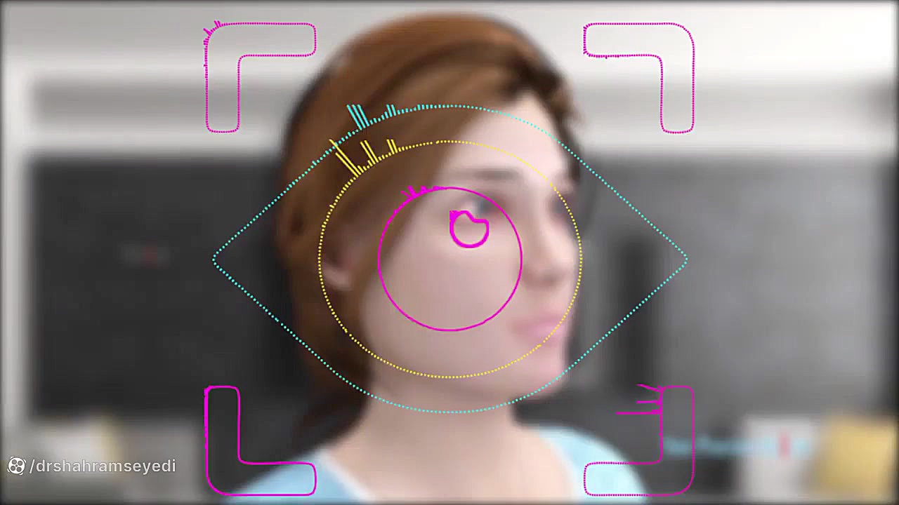 آیا آلرژی چشمی قابل درمان است؟ دکتر شهرام سیدی متخصص آلرژی و ایمونولوژی