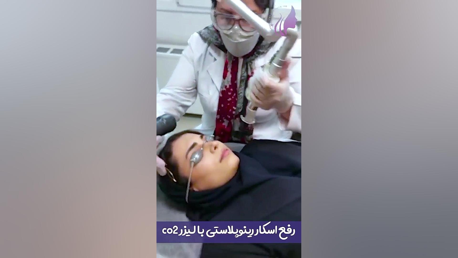 لیفت گردن وصورت با هایفو‌‌ دستگاه لیزر پالس فمتوثانیه
