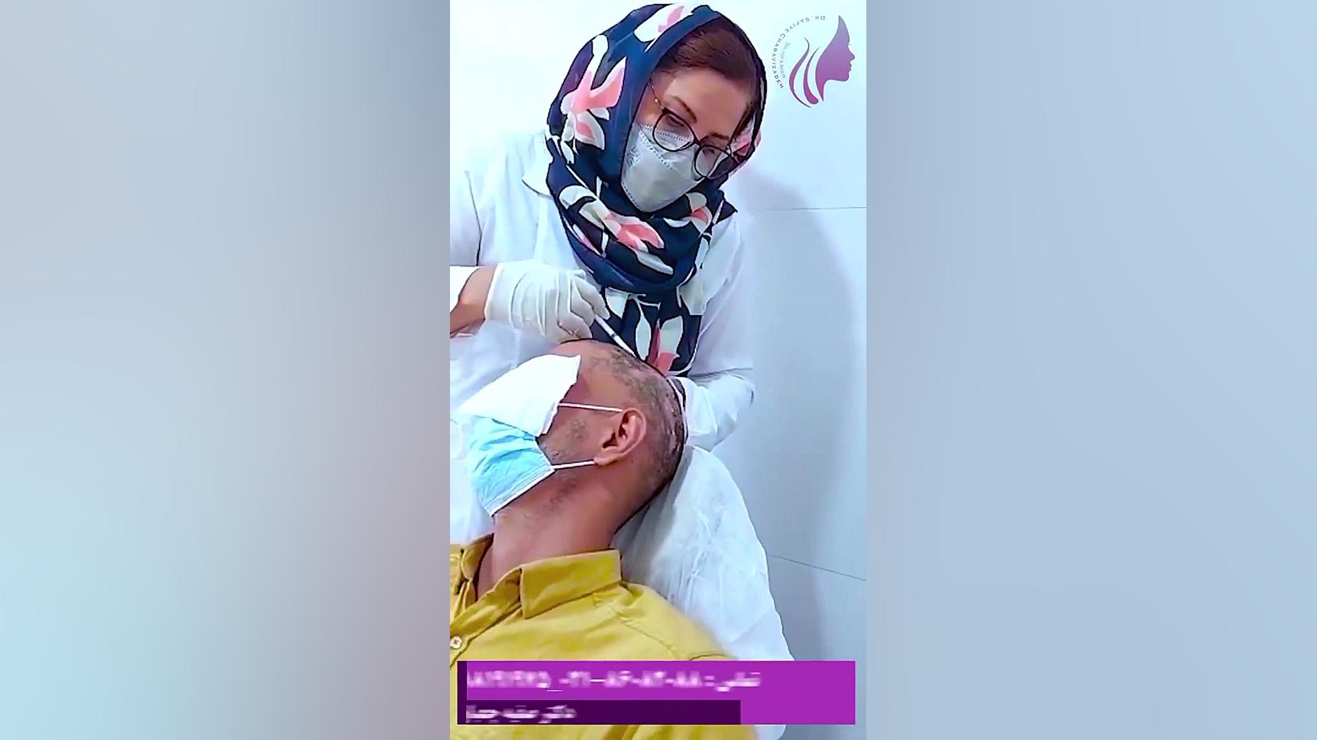 تزریق درون ضایعه ریزش مو سکه ای دکتر صفیه چعباوی زاده