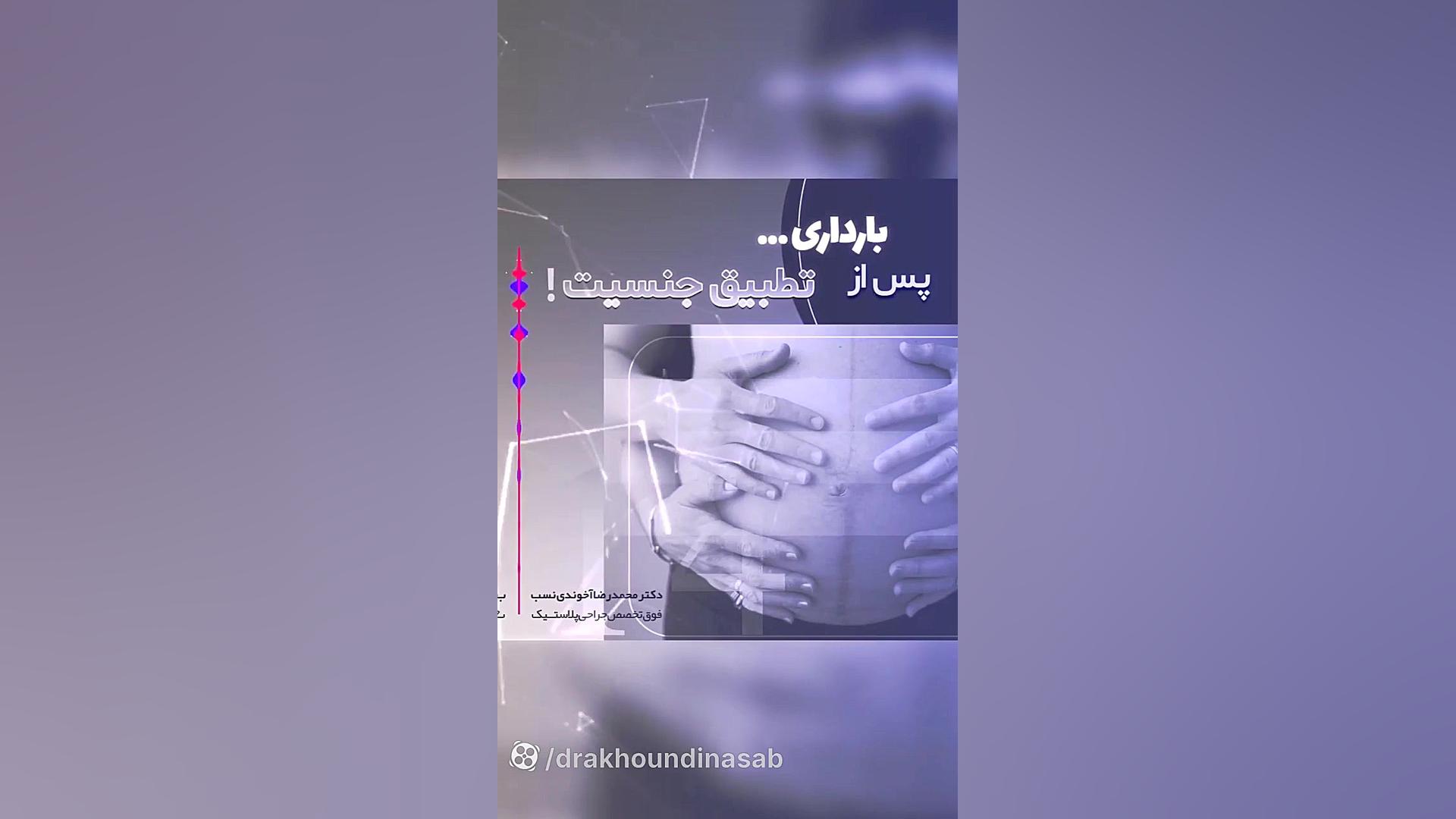 بارداری پس از تطبیق جنسیت دکتر محمدرضا آخوندی نسب-فوق تخصص جراحی پلاستیک