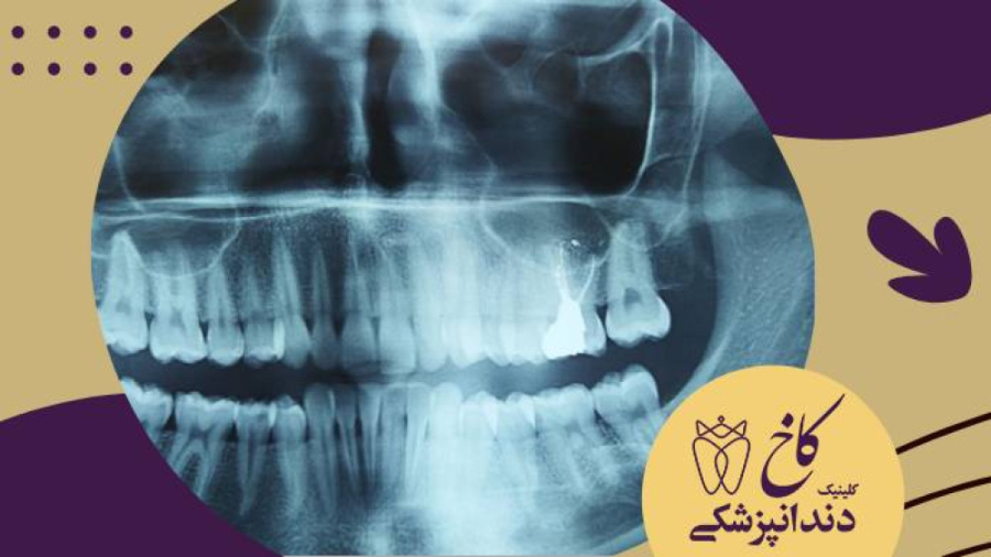 تصاویر رادیوگرافی بیماران کلینیک دندانپزشکی کاخ