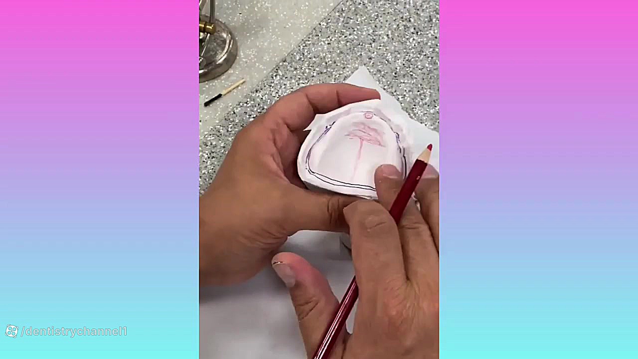 مبانی پروتز کامل ( ریلیف و آندر کات ) جلسه دوم جرمگیری