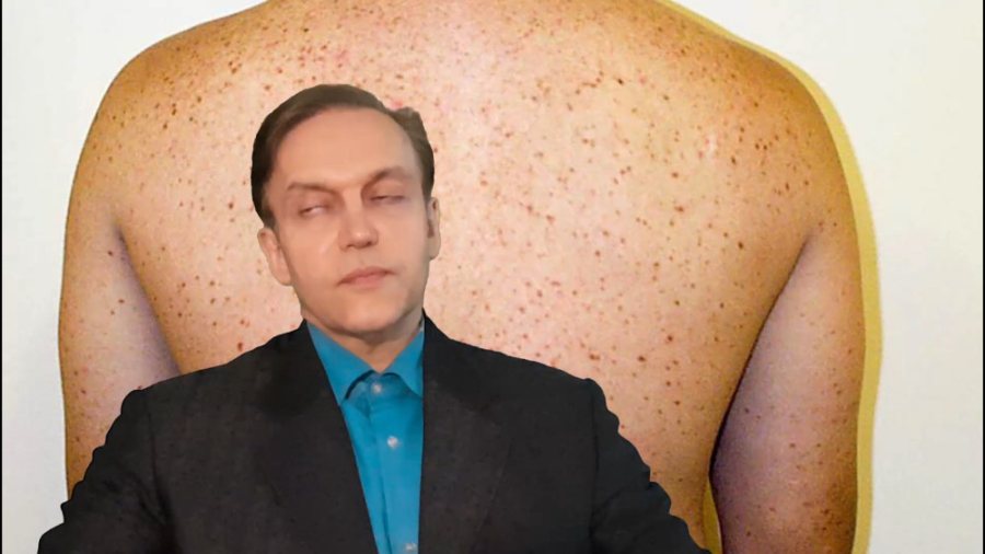 پرسش و پاسخ با استاد محمدرضا صفاری: درمان بیماری ماستوسیتوز Spatial Transcriptomics