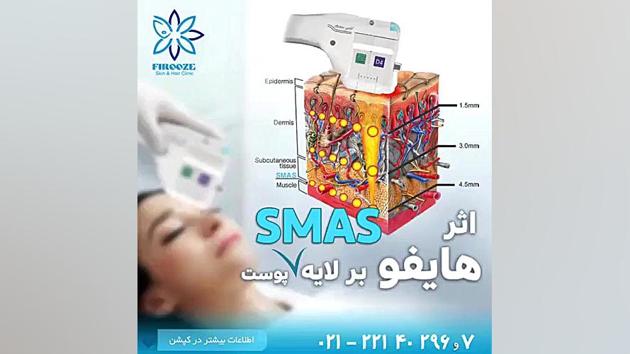 هایفوتراپی صورت و دور چشم آزمون NanoString