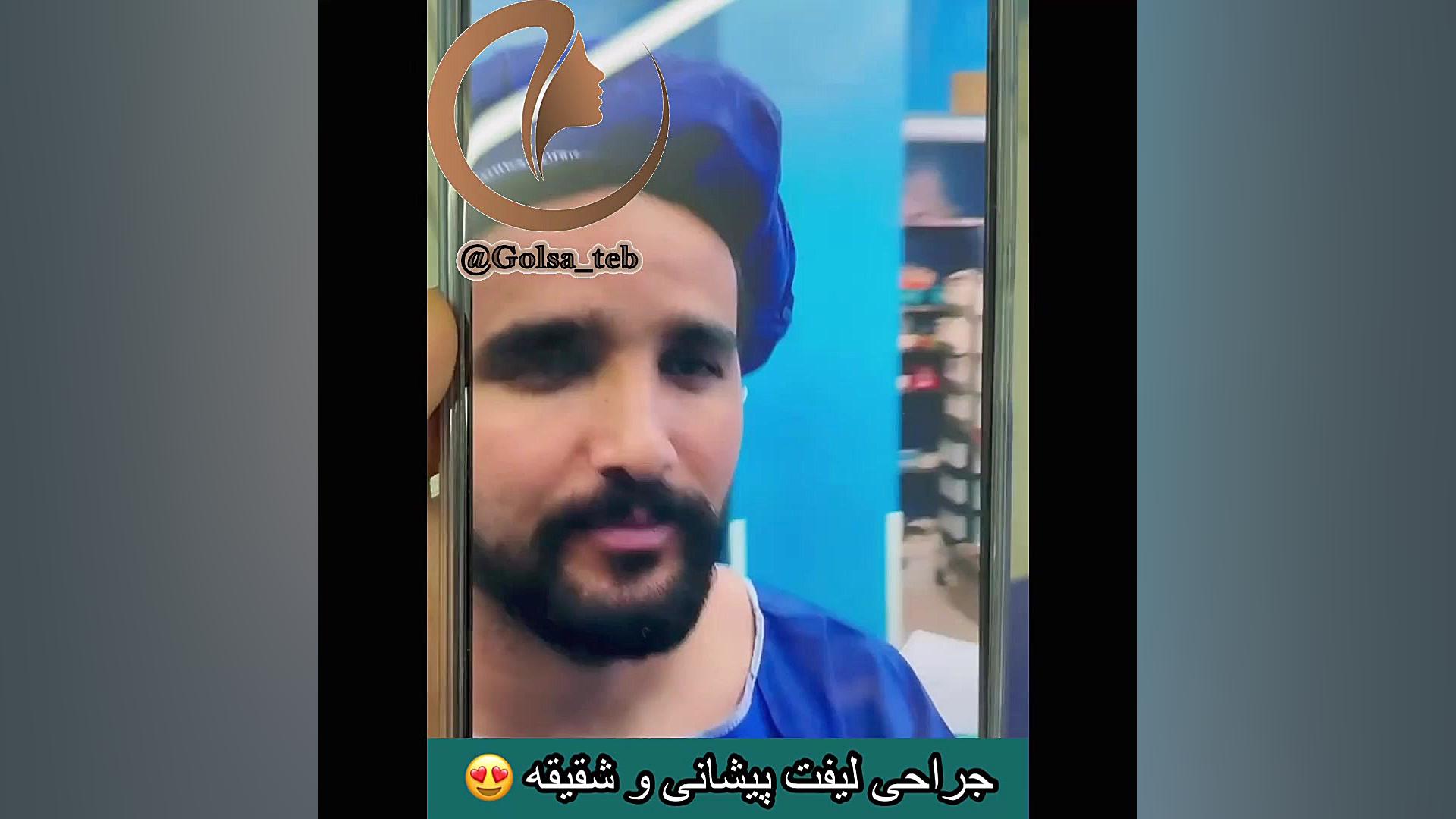 جراحی لیفت شقیقه همراه لیفت پیشانی رفع افتادگی پلک
