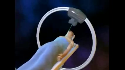 CT scan process بیماری آسپارتیل گلوکوزامینوریا