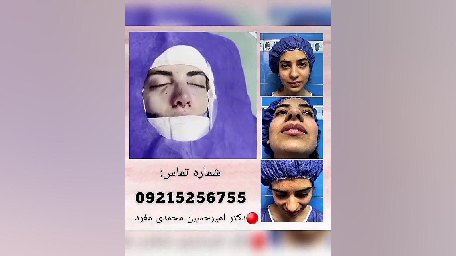 جراحي بيني توسط دكتر امير حسين محمدي مفرد دکتر امیر حسین محمدی مفرد