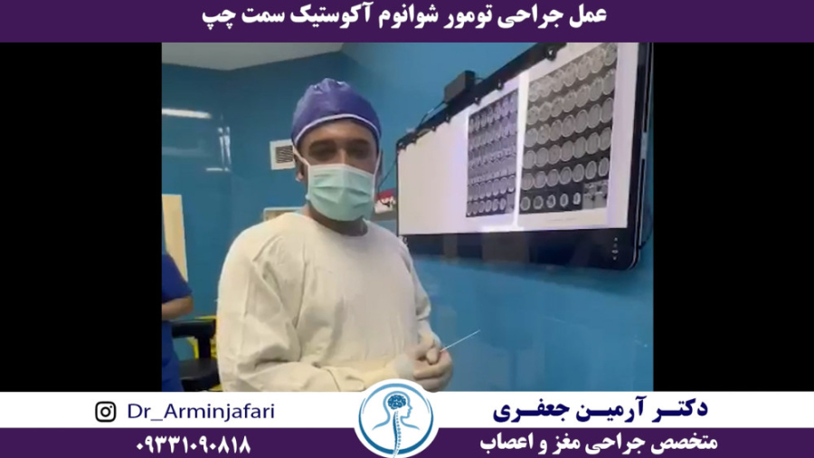 عمل جراحی تومور شوانوم آکوستیک سمت چپ پلاسماجت