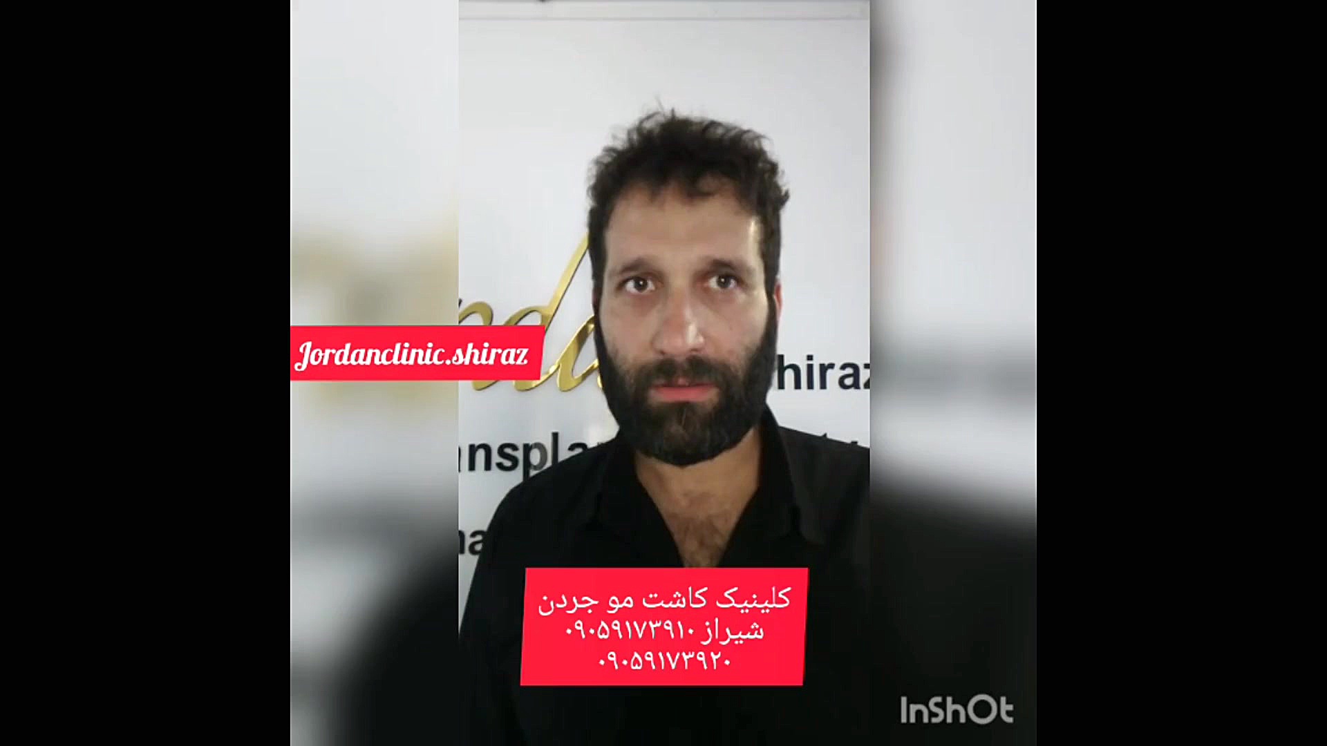 کلینیک کاشت مو و زیبایی جردن منافذ باز پوست