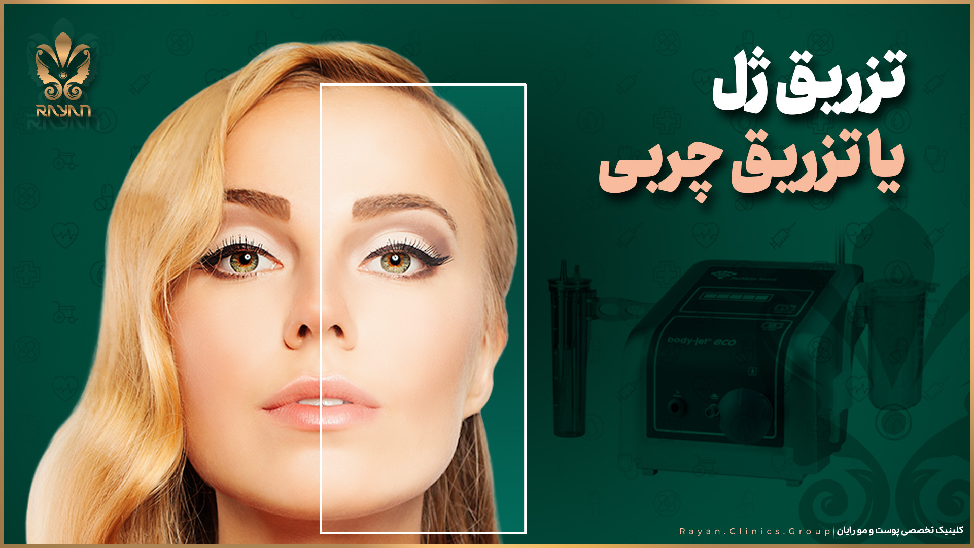 تزریق چربی یا ژل؟ بیماری آلبومینوری وراثتی