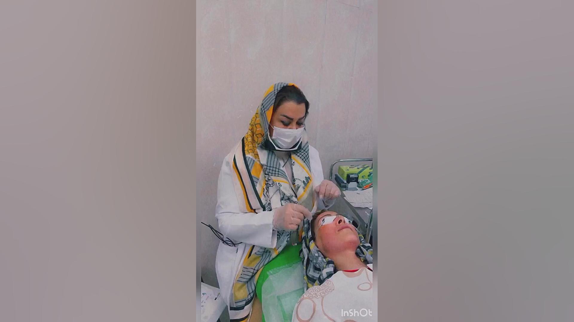 لیزر اندولیفت برای جوانسازی زیر چشم دکتر فرحناز زینعلی - متخصص پوست، مو، زیبایی زنجان