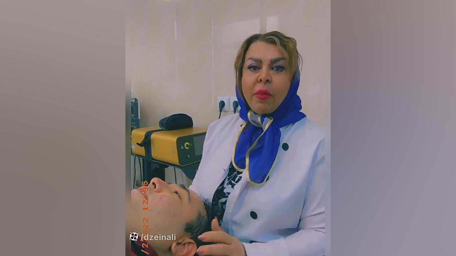 رفع اسکارهای فرورفته آکنه با انجام ساب سیژن اندولیفت و آر اف فرکشنال دکتر فرحناز زینعلی - متخصص پوست، مو، زیبایی زنجان