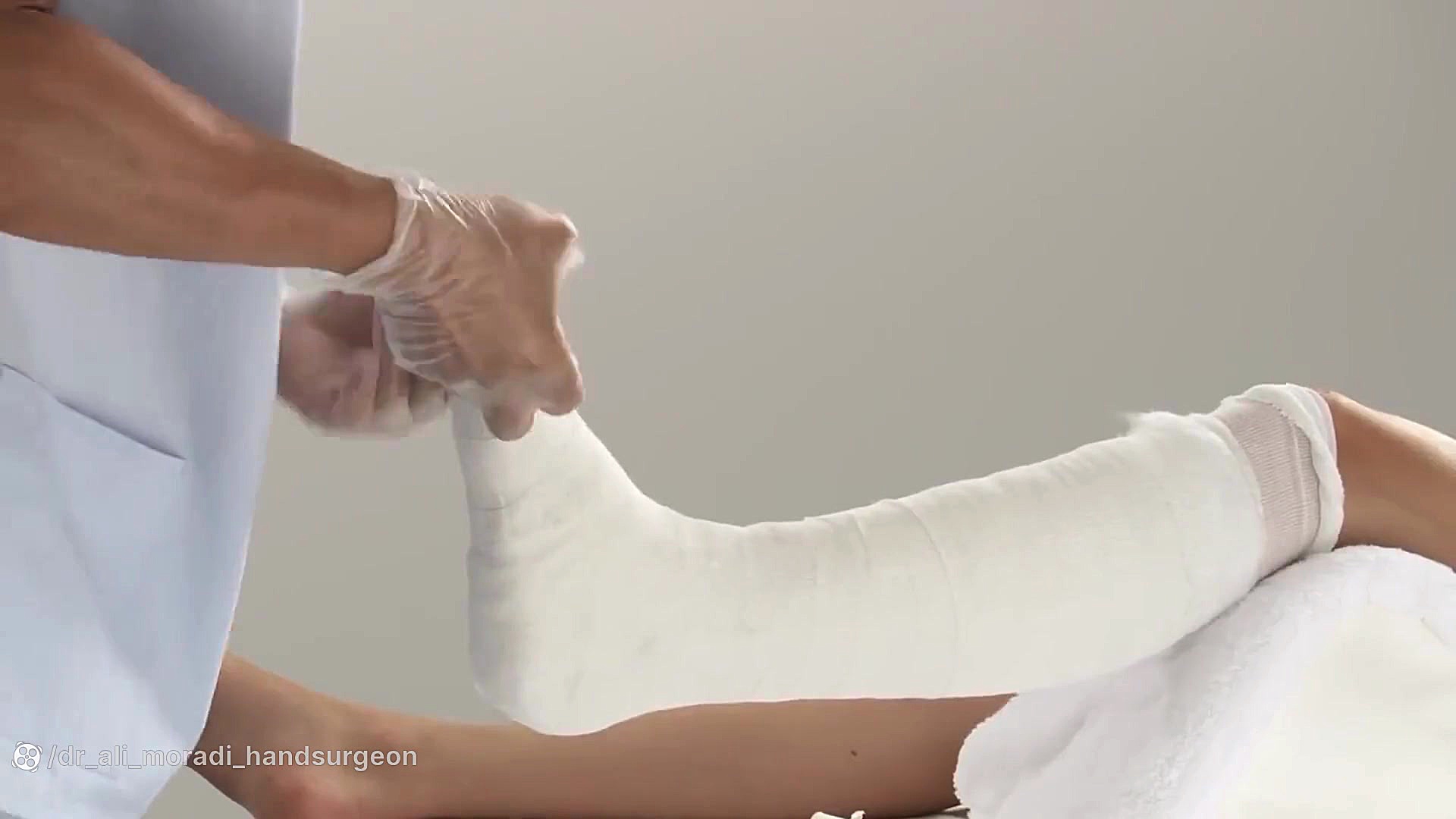 Lower Leg Splint دکتر علی مرادی جراح دست