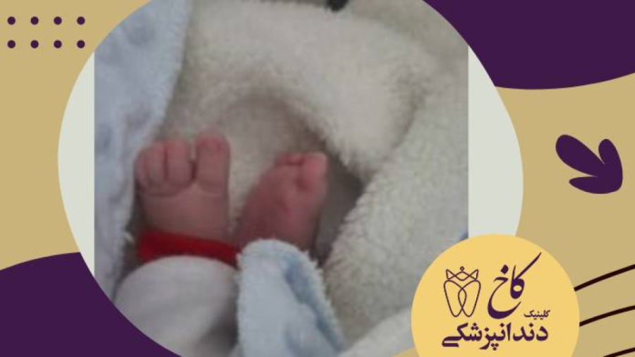 پا کوچولو کلینیک دندانپزشکی کاخ