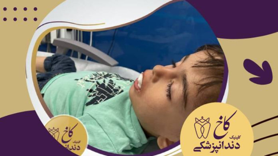 کشیدن دندان شیری تحت سدیشن کلینیک دندانپزشکی کاخ