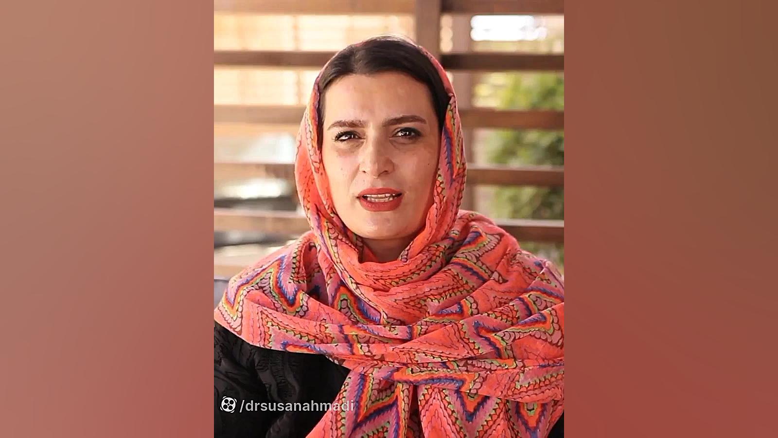 درمان لک صورت با لیزر | دکتر سوسن احمدی دکتر سوسن احمدی پیر شهید