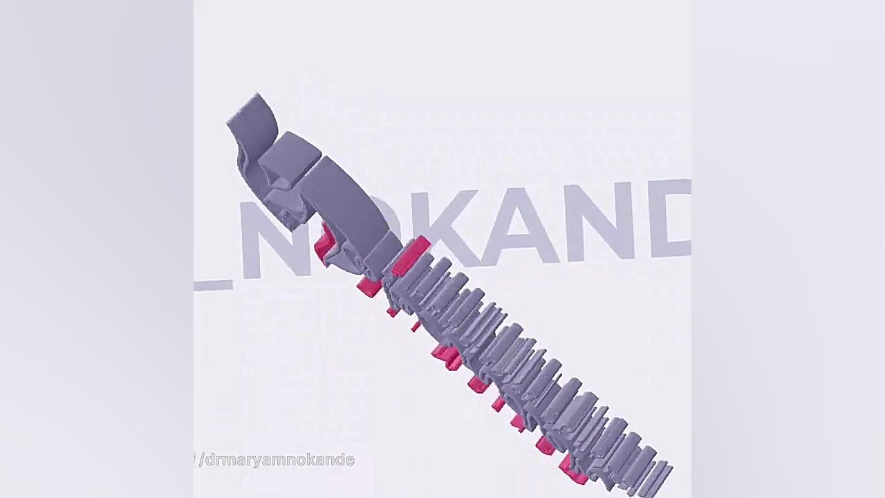 اسکلروتراپی برای درمان رگ های واریسی پا دکتر مریم نوکنده