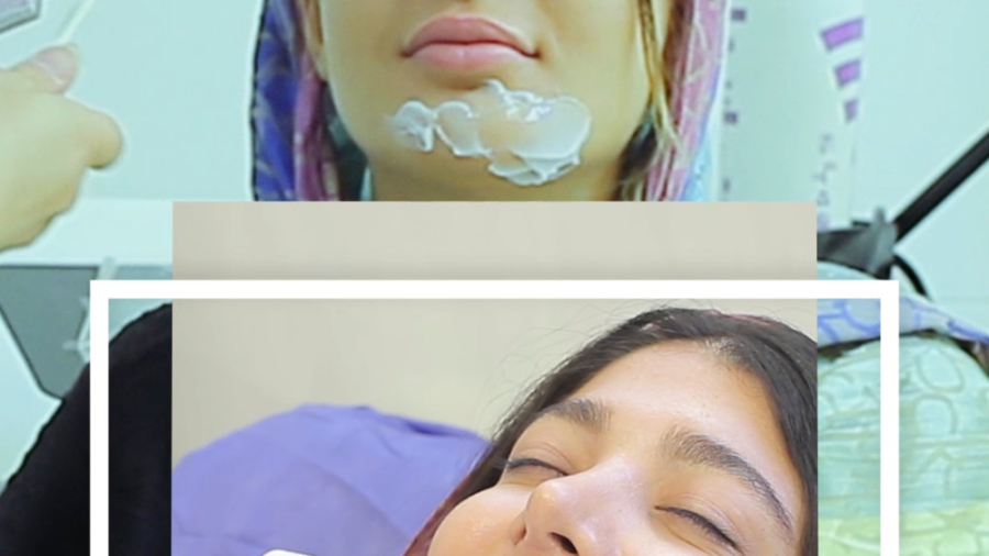 تزریق ژل برای اصلاح فرم چانه نوروجراحی فانکشنال