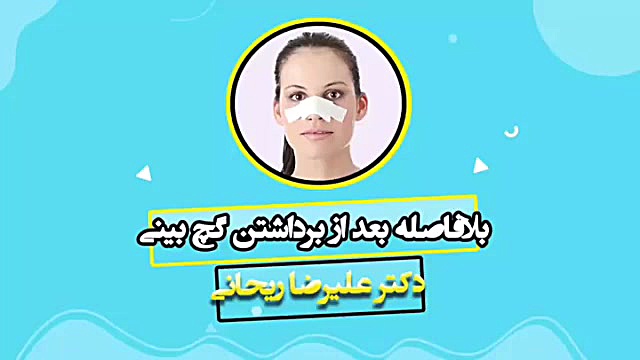 فیلم قبل و بعد از جراحی بینی لمینت