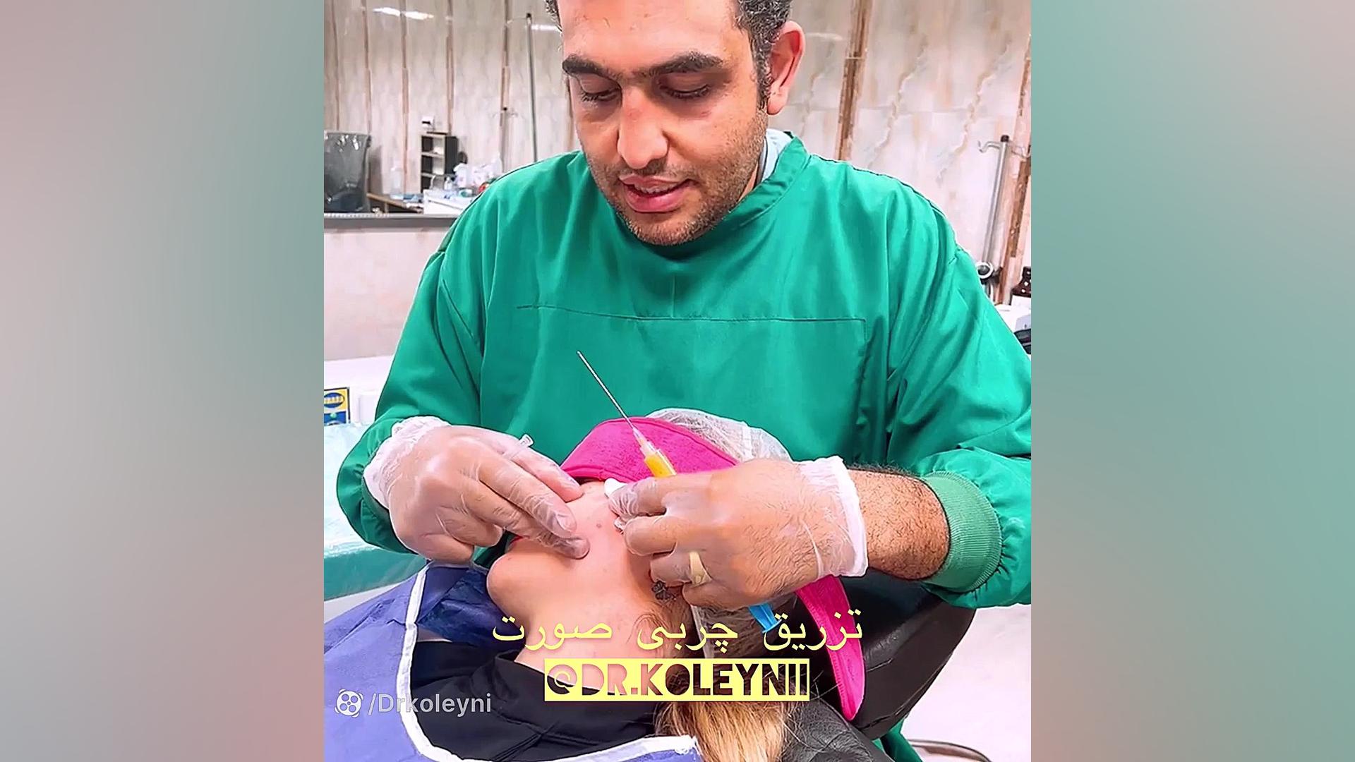 تزریق چربی نانوفت صورت توسط دکتر نعیم کلینی 09359503714 pCO2