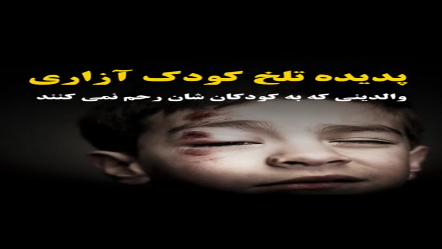 پدیده تلخ کودک‌آزاری | والدینی که به کودک‌‌شان رحم نمی‌کنند دکتر سید حسن موسوی چلک