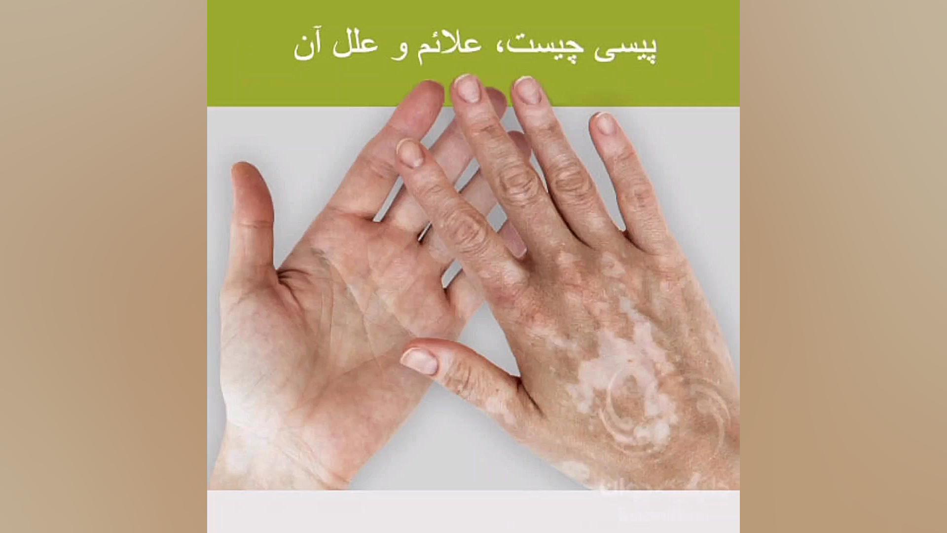 رنگ دوباره شکر پنیر