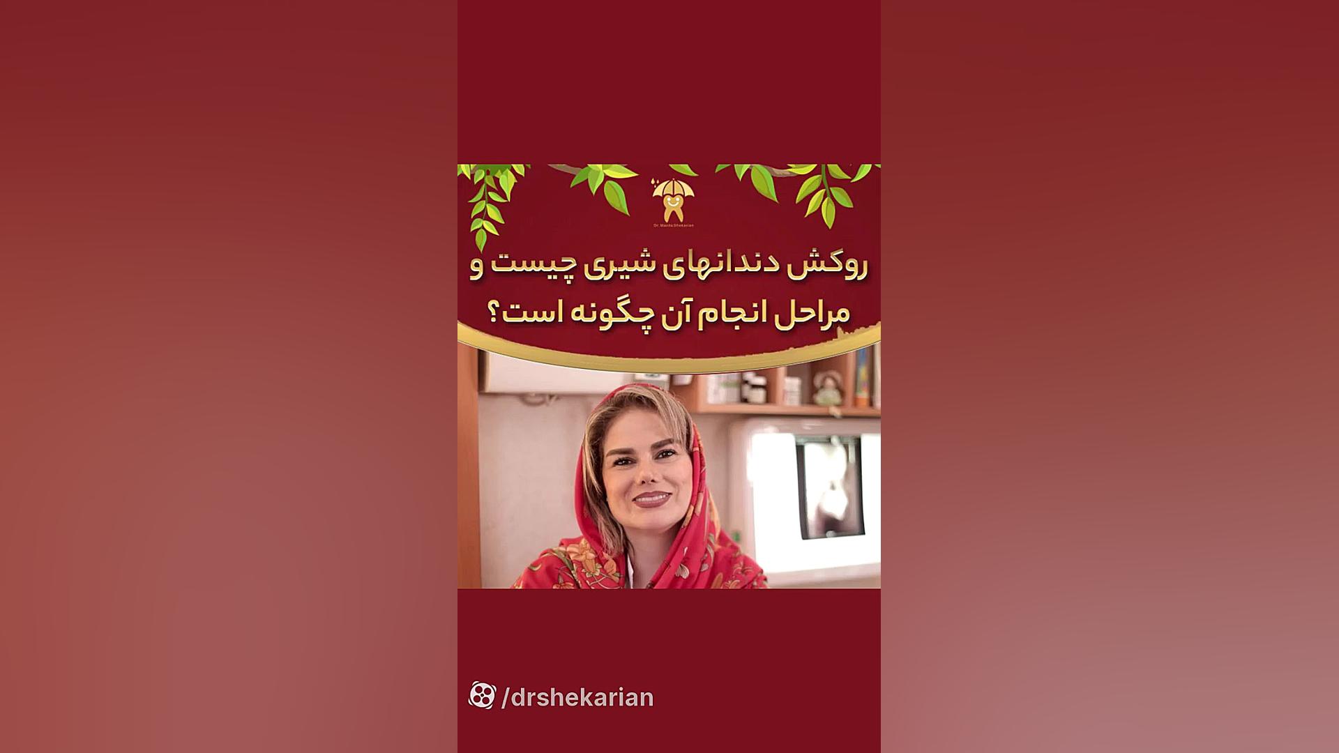 روکش دندان شیری چیست؟| دکتر ماریتا شکاریان بیماری سندرم فریمن شلدون