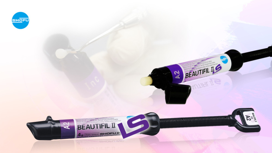 کامپوزیت ونیر با کامپوزیت شوفو Beautifil II LS لیزر فرکشنال