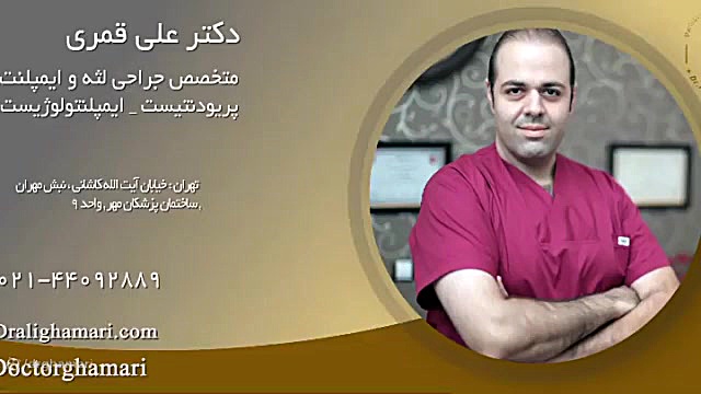 ️ایمپلنت جایگزینی برای دندان های از دست رفته️ دکتر علی قمری - متخصص جراحی لثه و ایمپلنت