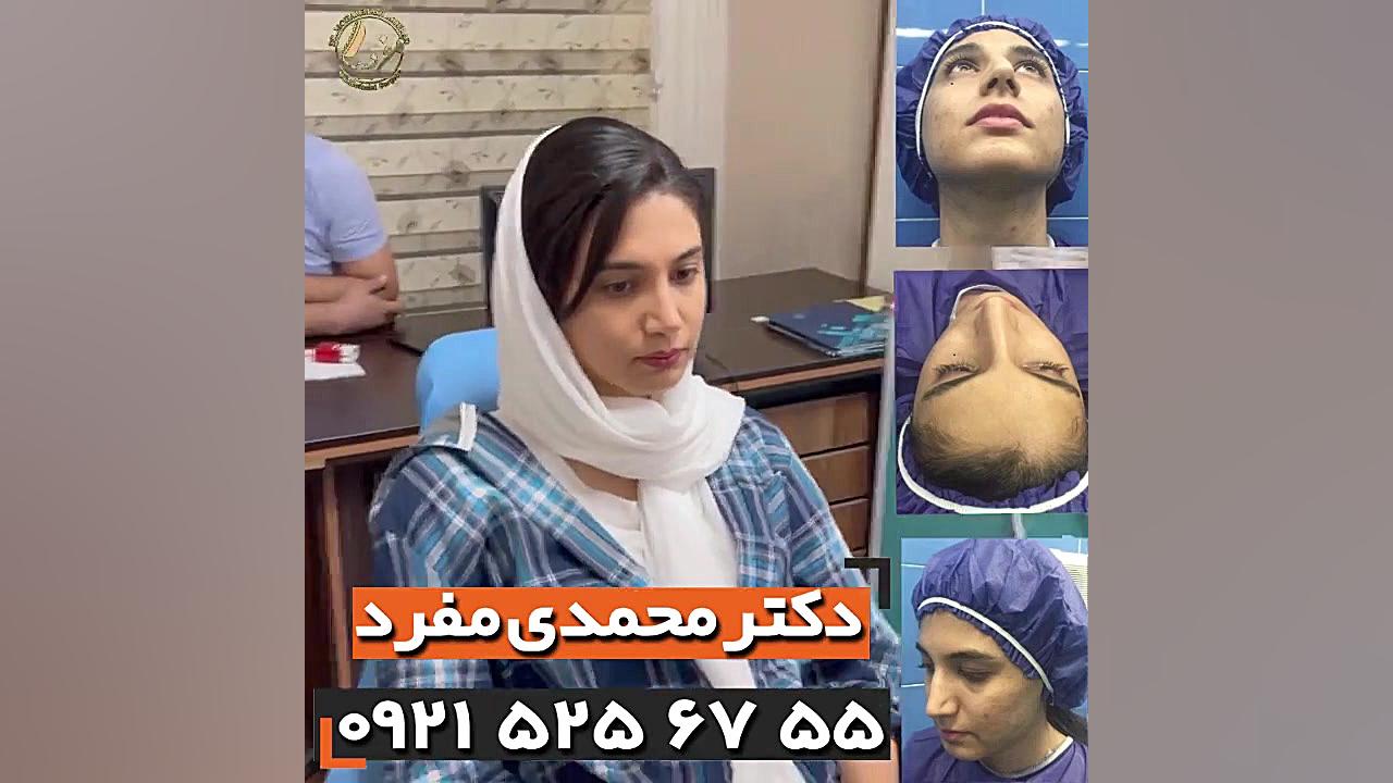 عمل زیبایی بینی ، دکتر امیرحسین محمدی مفرد 09215256755 دکتر امیر حسین محمدی مفرد