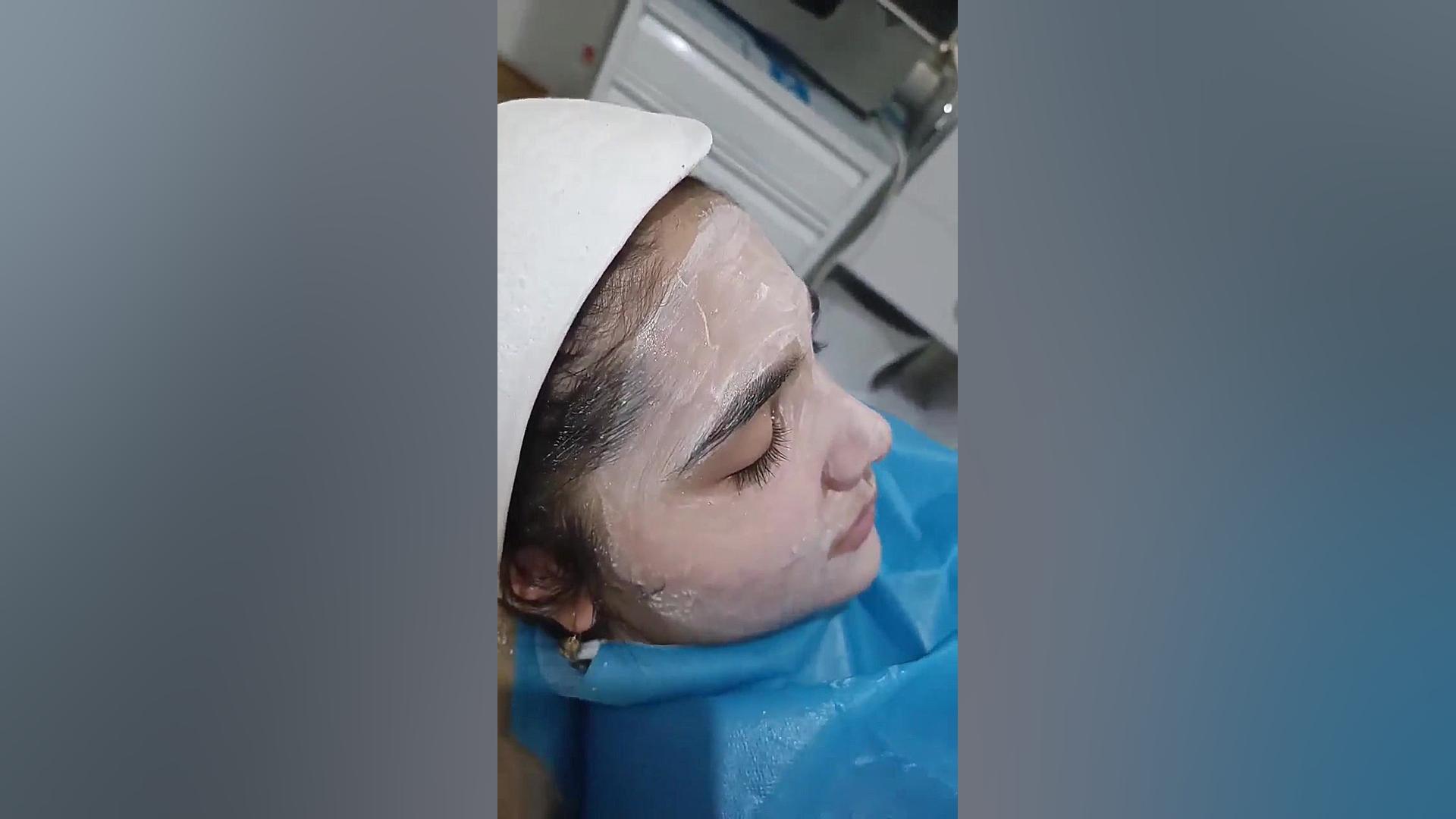 پوست کره ای ماموپلاستی
