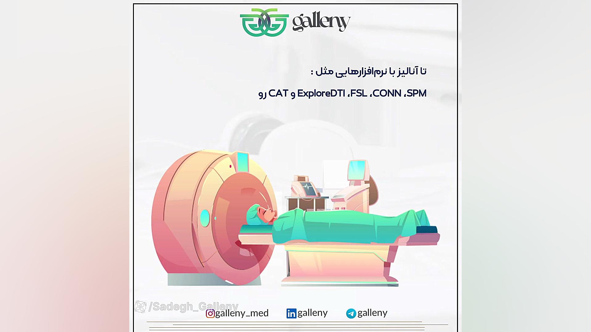 یادگیری MRI با گالنی پروفایل