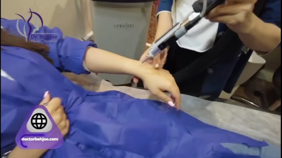 لیزر موهای زائد در مطب دکتر شاهین بهجو دکتر شاهین بهجو - فوق تخصص جراحی پلاستیک