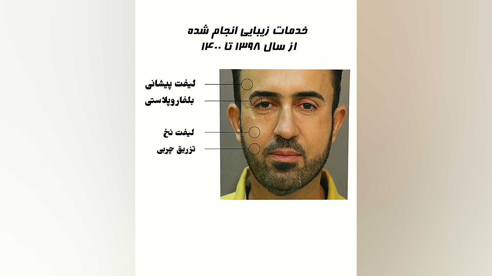 جوانسازی پوست در آقایان ترمیم زیبایی دندان