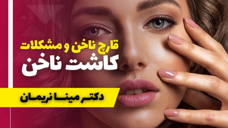 قارچ ناخن و مشکلات کاشت ناخن