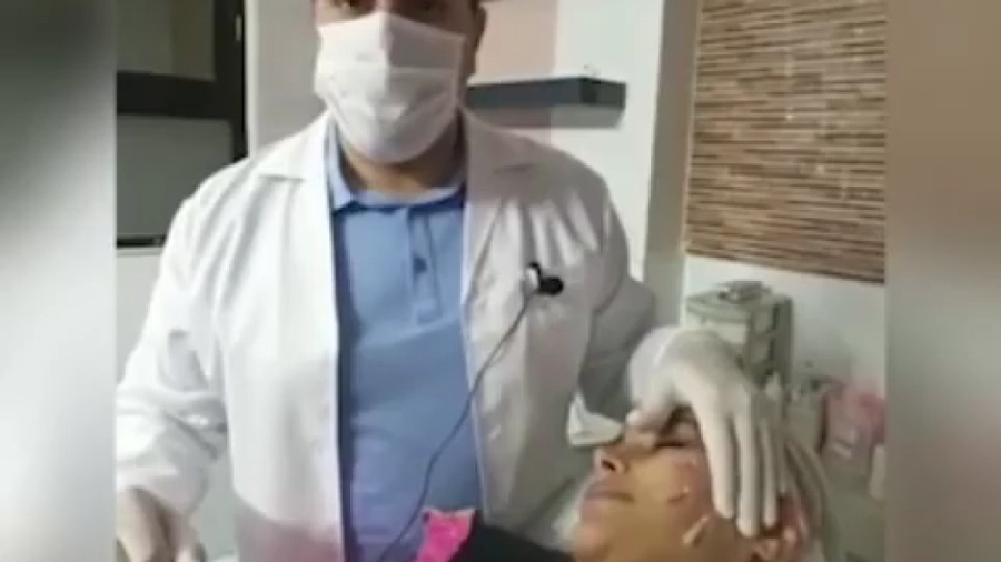 لیفت صورت با نخ به روش کلاسیک آتپازیب