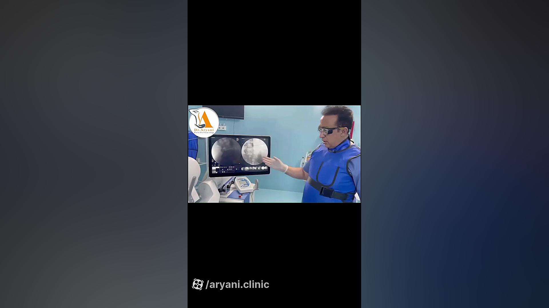 نحوه درمان تعریق زیاد کف پا تزریق ژل