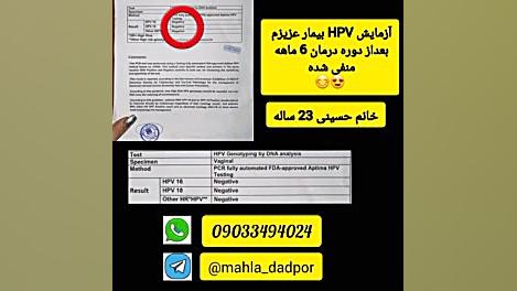 درمان زگیل تناسلی شهره سلطانی