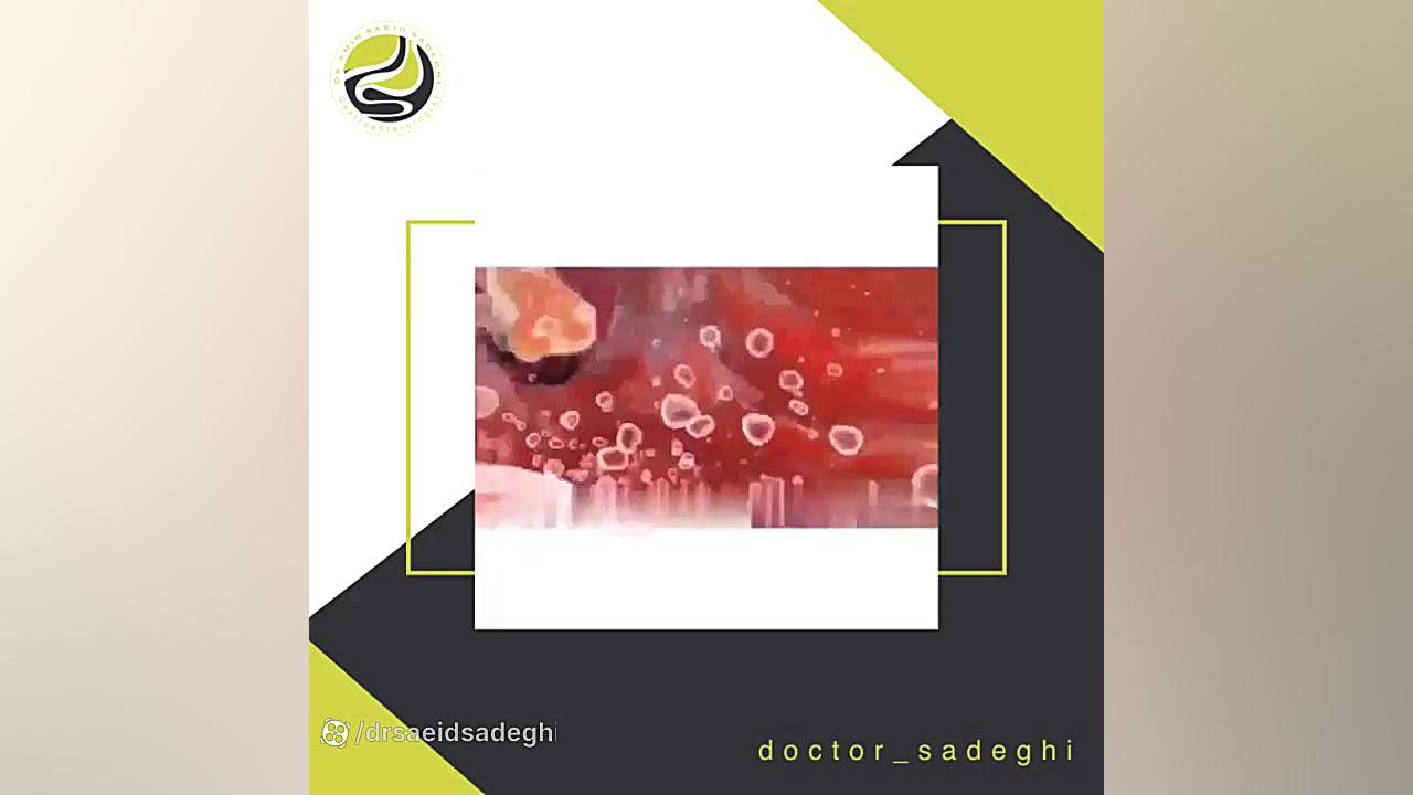 نحوه عملکرد معده دکتر امیر سعید صادقی (فوق تخصص گوارش و کبد)