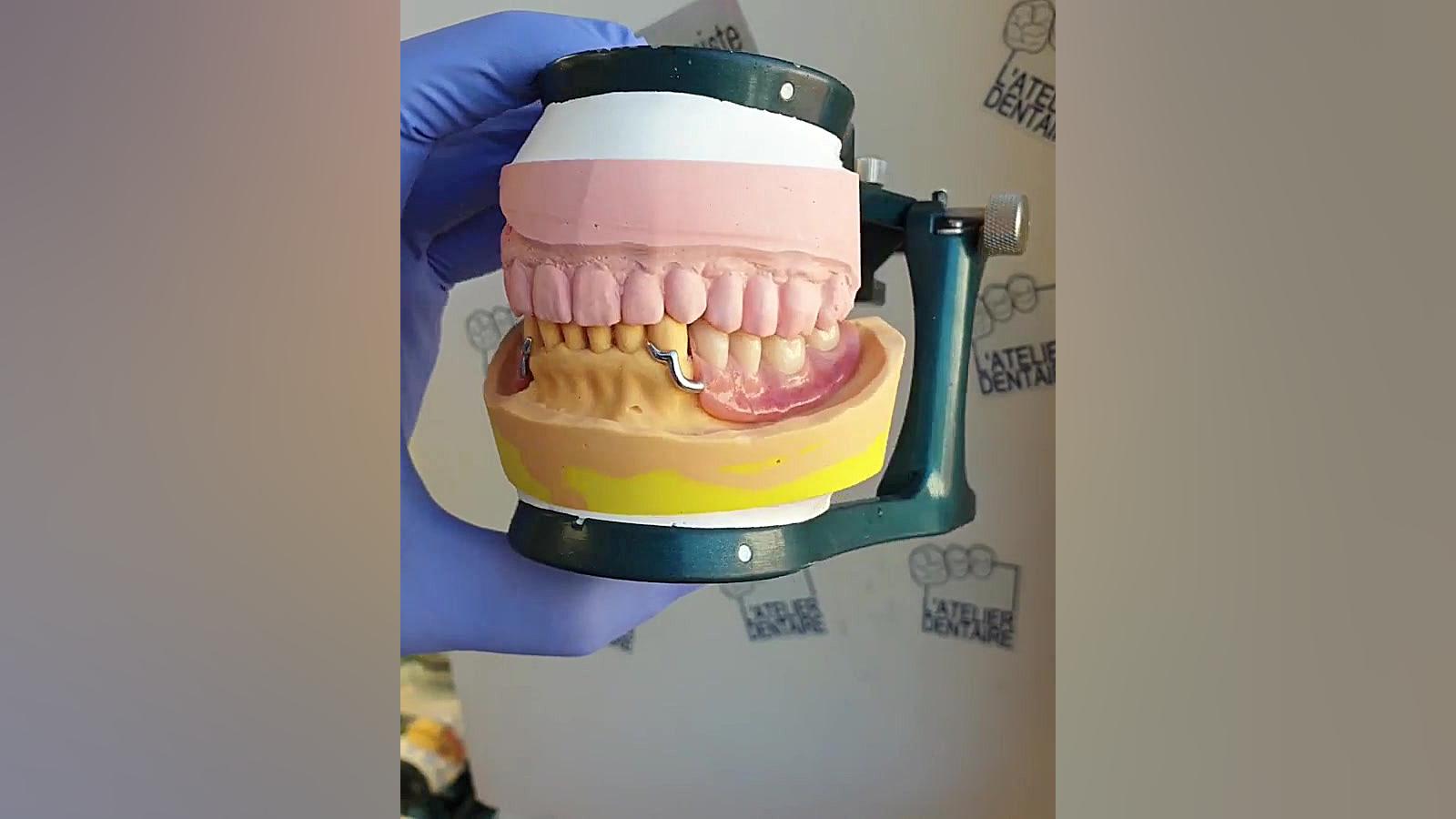 ساخت انواع دندان مصنوعی متحرک با بهترین کیفیت و قیمت بصرفه Synaptic Vesicle Tracking